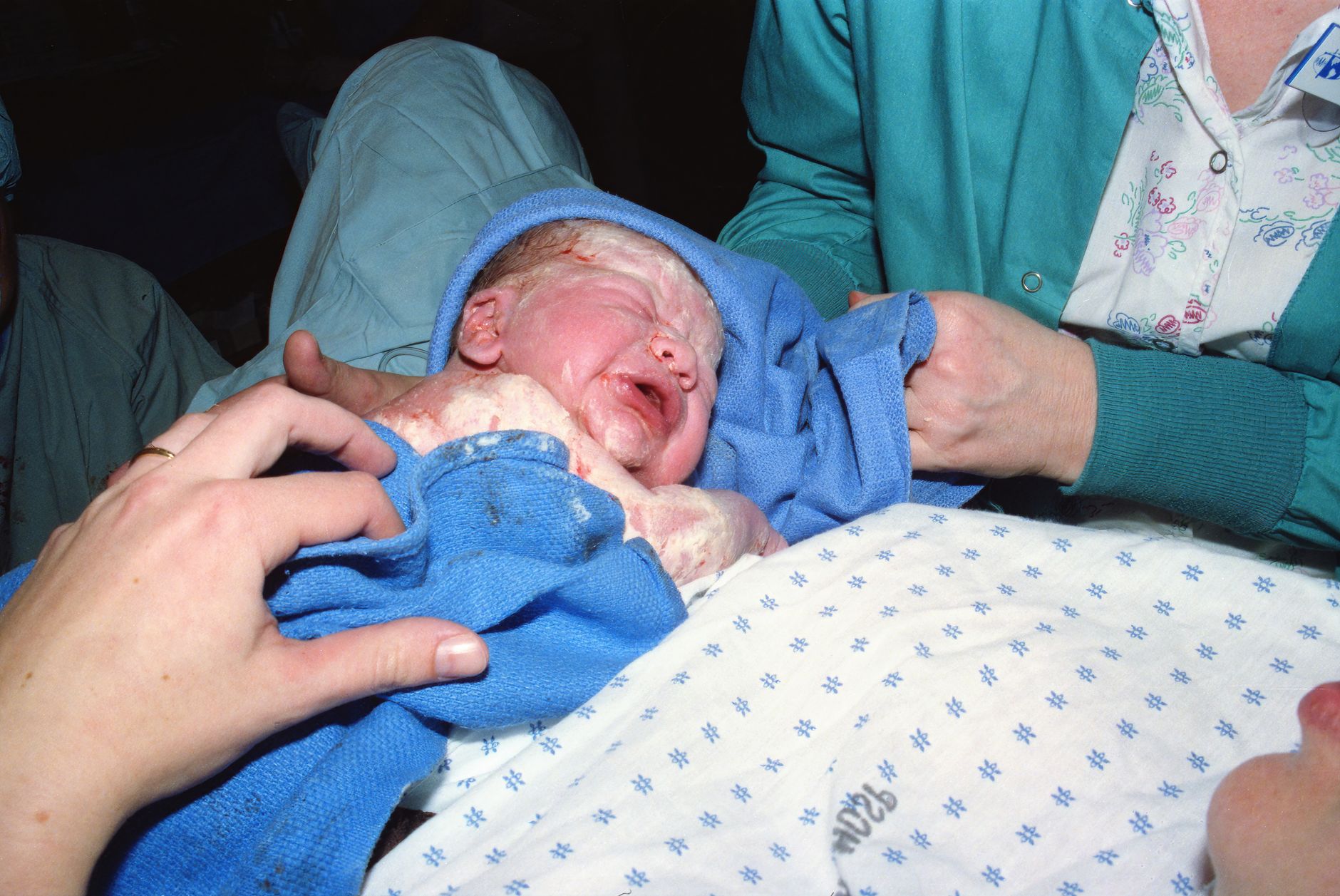 Deaths Outpacing Births: A Clear Warning for Australia